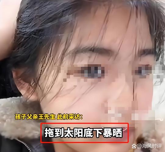 医院回应女童铊中毒